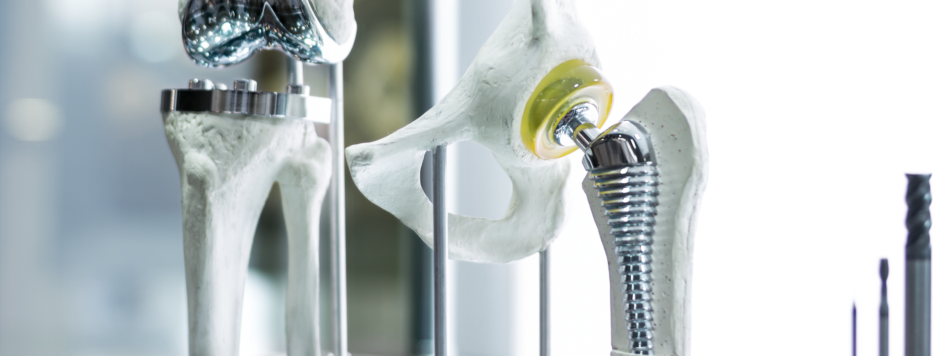 Models of hip and knee joints with metallic prosthetic implants